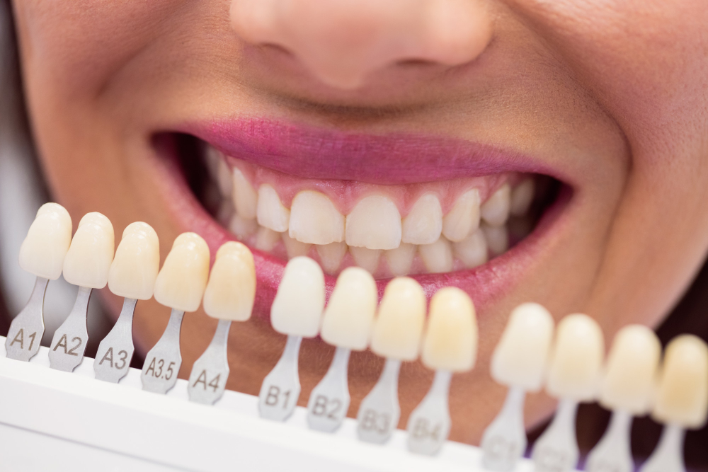 Dental crown treatment explained